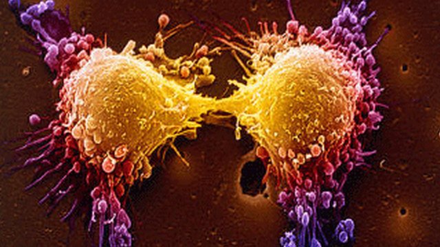 Prostate Cancer Cell Replication